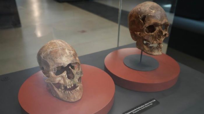 Birçok kişinin ölümüyle sonuçlandı! 5 bin yıllık ameliyat edilen kafatası Samsun`da sergileniyor