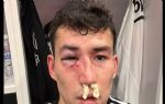 Bahtiyar Zaynutdinov sakatlandı, Beşiktaş`tan tepki geldi